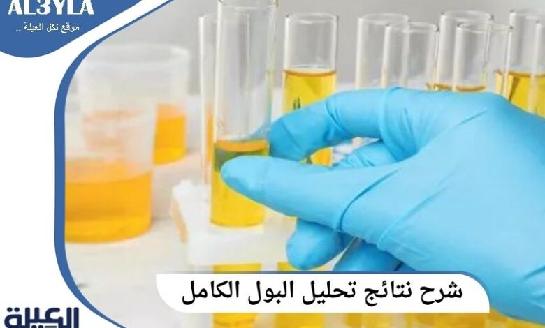 شرح نتائج تحليل البول الكامل (Complete Urine Analysis)