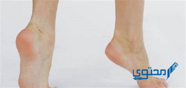 علاج وجع كعب الرجل