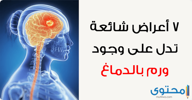 أعراض ورم المخ بالتفصيل