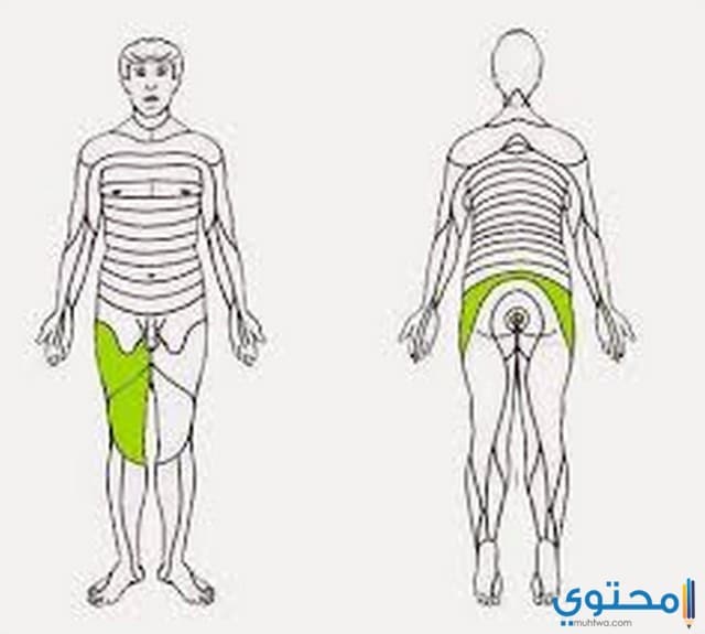 عرق النسا