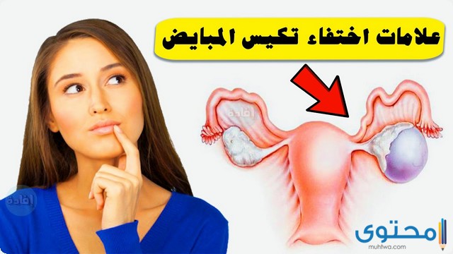 علامات اختفاء تكيس المبايض 